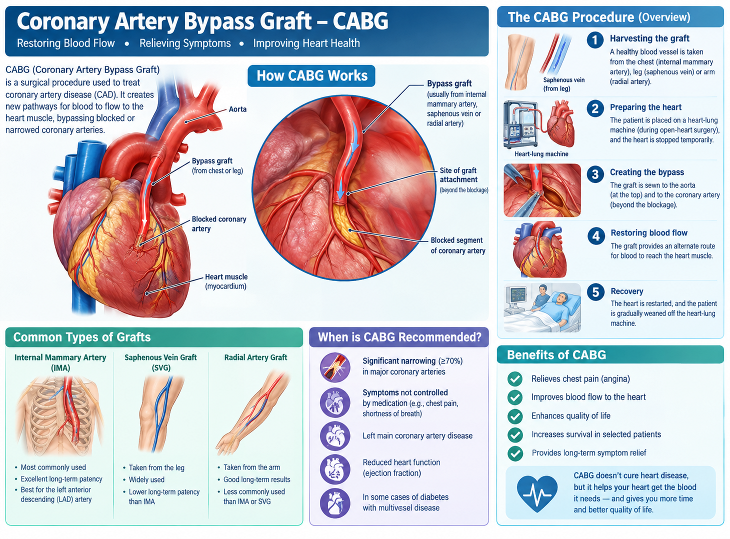 Coronary Artery Bypass Graft – CABG